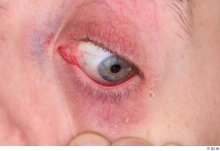 HD Eyes Alex Lee eye eyelash iris pupil skin texture…